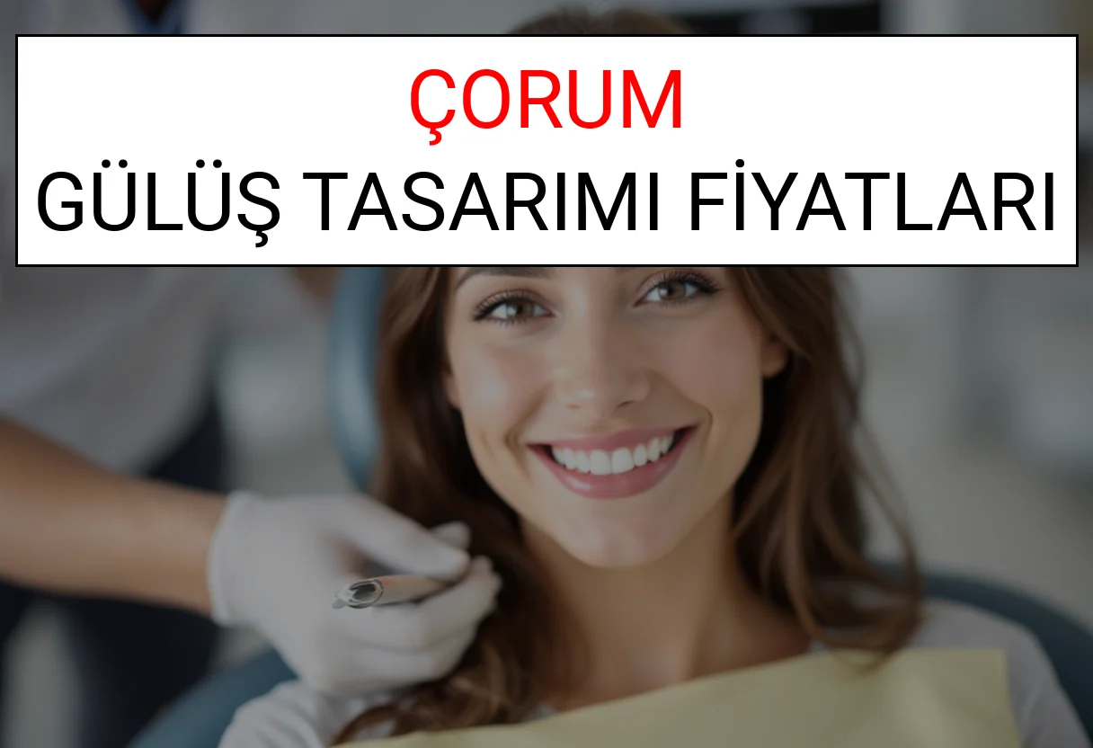Çorum Gülüş Tasarımı Fiyatları Ne Kadar? (2025 Çorum TDB Gülüş Estetiği Ücreti)