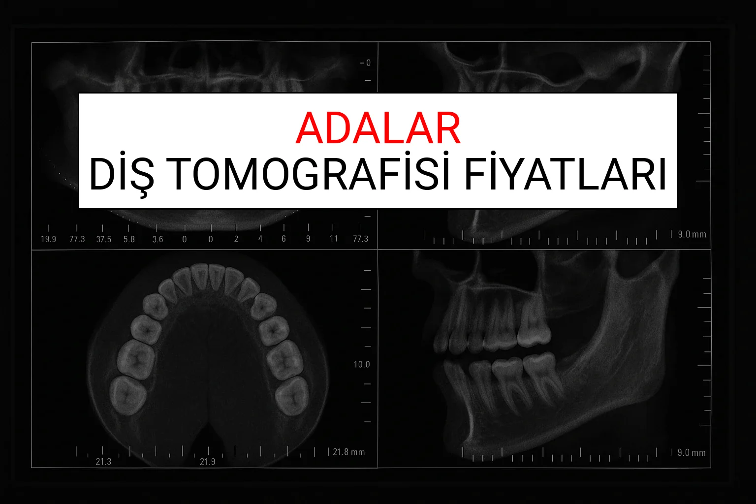 Adalar Diş Tomografisi Fiyatları Ne Kadar? (2025 TDB Adalar Diş Tomografisi Ücreti)