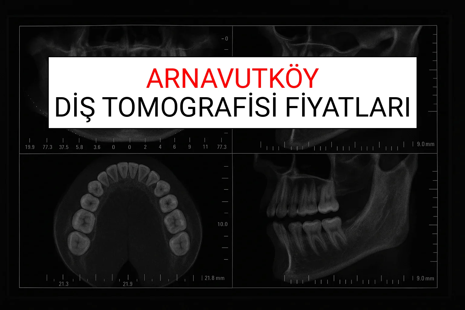 Arnavutköy Diş Tomografisi Fiyatları Ne Kadar? (2025 TDB Arnavutköy Diş Tomografisi Ücreti)