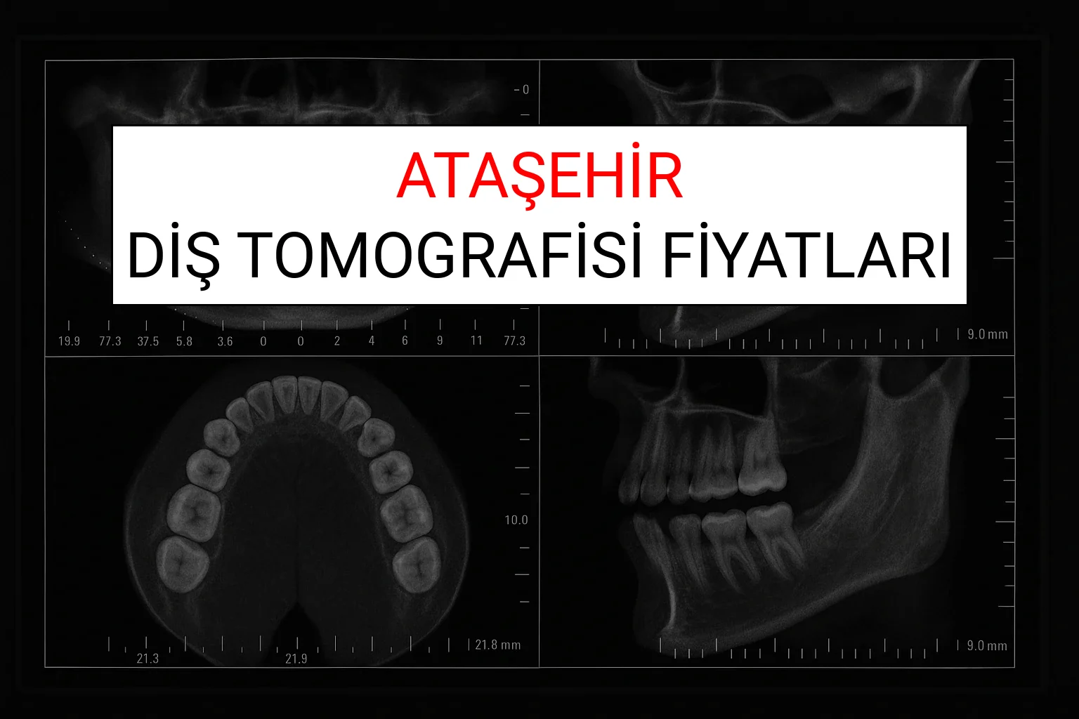 Ataşehir Diş Tomografisi Fiyatları Ne Kadar? (2025 TDB Ataşehir Diş Tomografisi Ücreti)