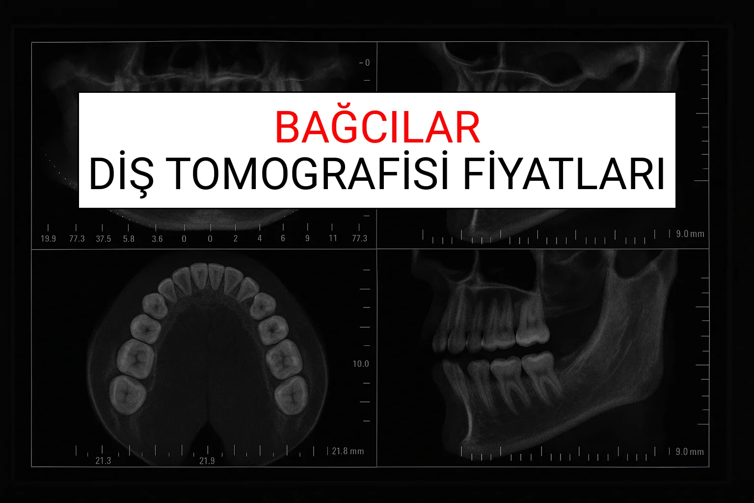 Bağcılar Diş Tomografisi Fiyatları Ne Kadar? (2025 TDB Bağcılar Diş Tomografisi Ücreti)