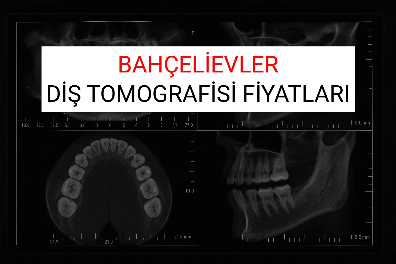 Bahçelievler Diş Tomografisi Fiyatları Ne Kadar? (2025 TDB Bahçelievler Diş Tomografisi Ücreti)