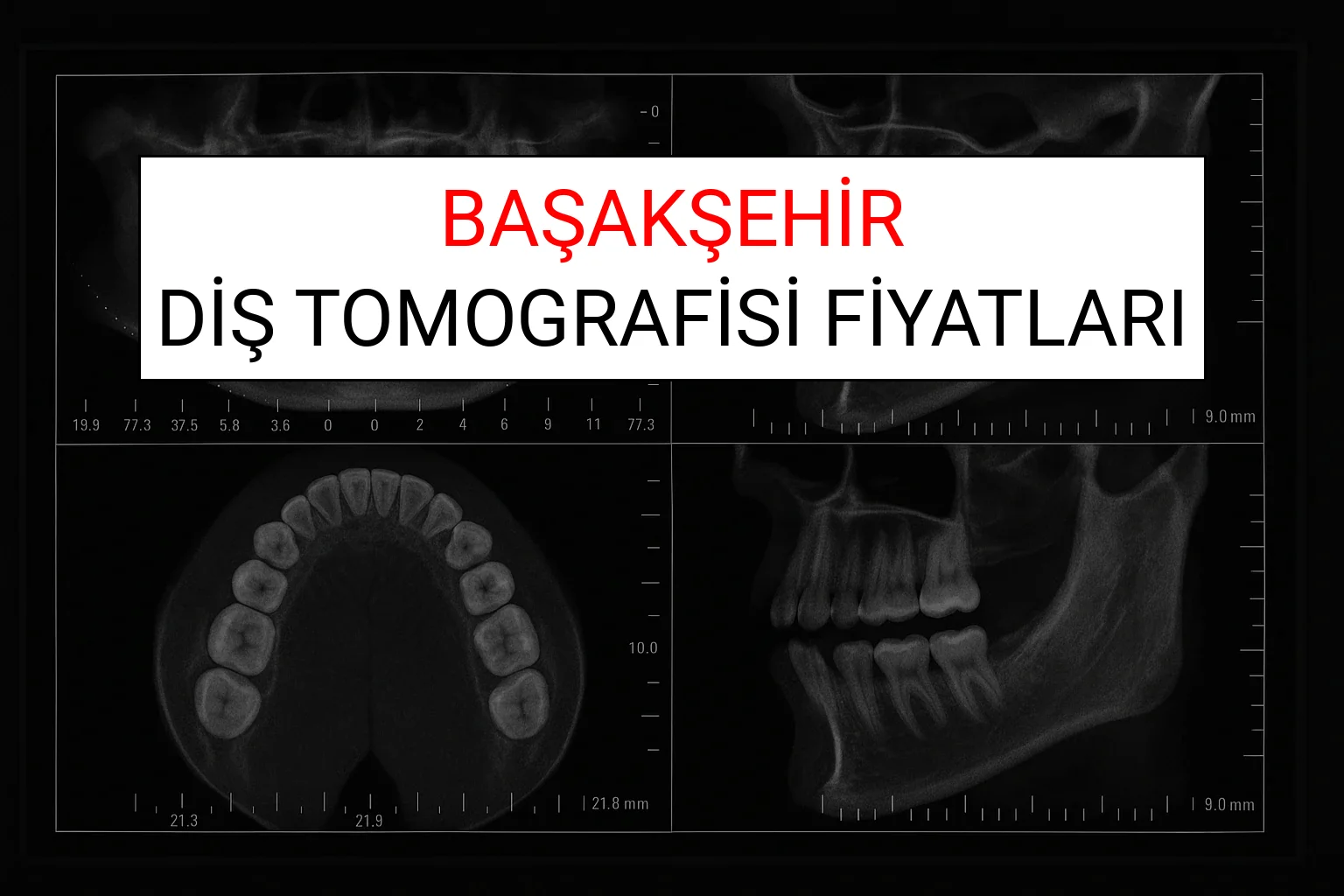 Başakşehir Diş Tomografisi Fiyatları Ne Kadar? (2025 TDB Başakşehir Diş Tomografisi Ücreti)