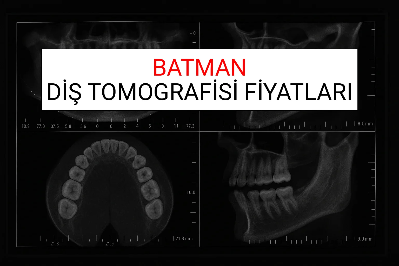 Batman Diş Tomografisi Fiyatları Ne Kadar? (2025 TDB Batman Diş Tomografisi Ücreti)