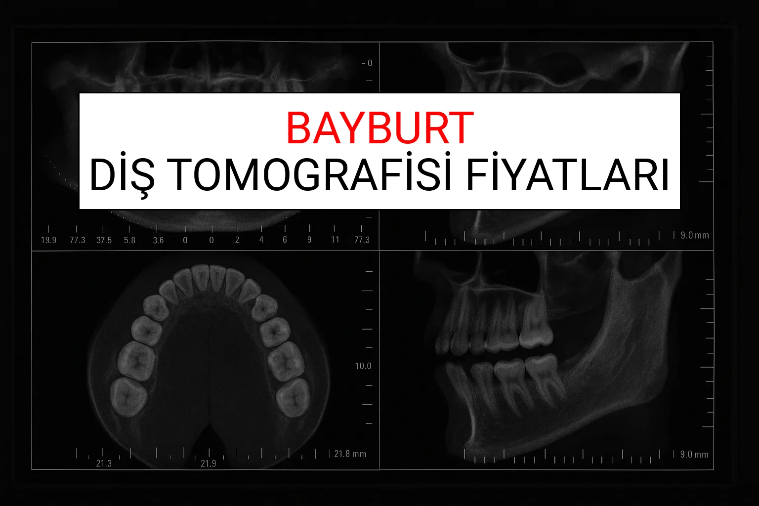 Bayburt Diş Tomografisi Fiyatları Ne Kadar? (2025 TDB Bayburt Diş Tomografisi Ücreti)