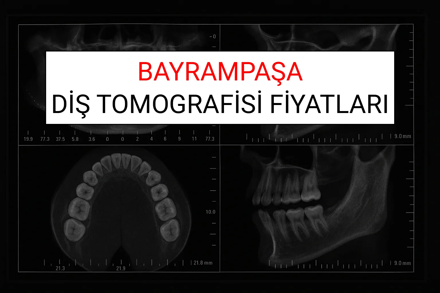 Bayrampaşa Diş Tomografisi Fiyatları Ne Kadar? (2025 TDB Bayrampaşa Diş Tomografisi Ücreti)