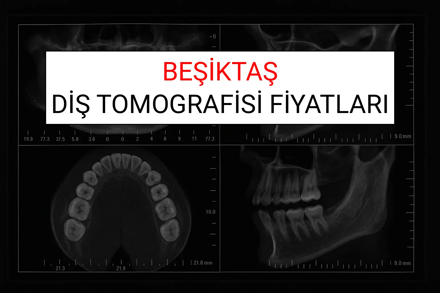 Beşiktaş Diş Tomografisi Fiyatları Ne Kadar? (2025 TDB Beşiktaş Diş Tomografisi Ücreti)