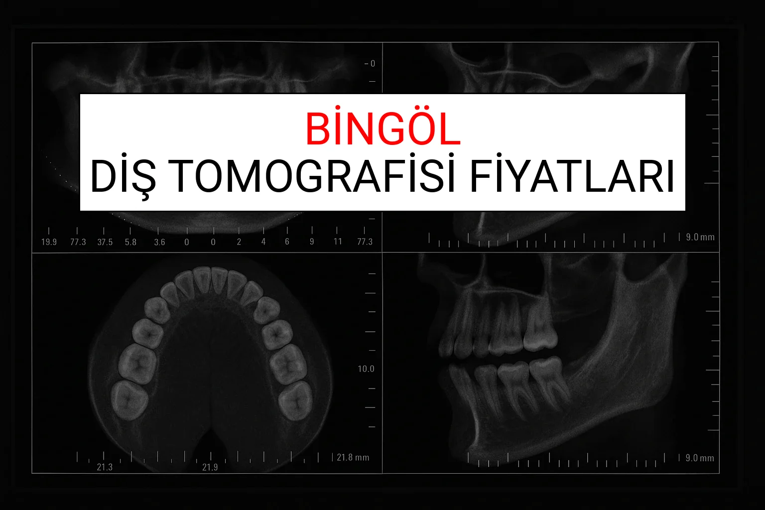 Bingöl Diş Tomografisi Fiyatları Ne Kadar? (2025 TDB Bingöl Diş Tomografisi Ücreti)
