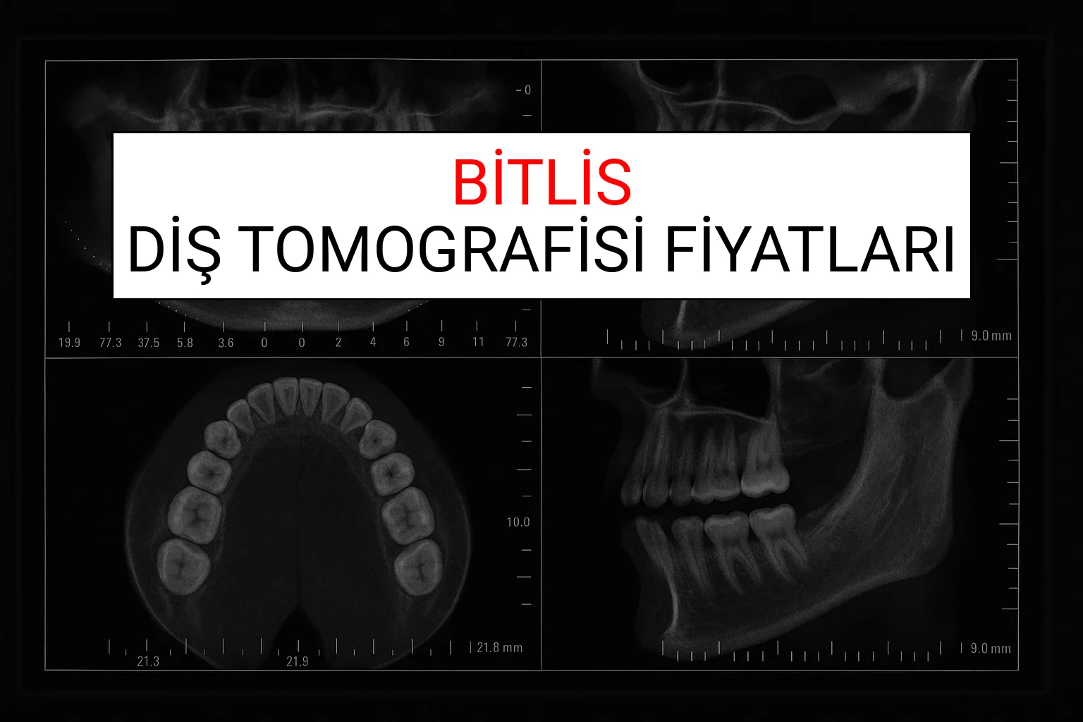 Bitlis Diş Tomografisi Fiyatları Ne Kadar? (2025 TDB Bitlis Diş Tomografisi Ücreti)