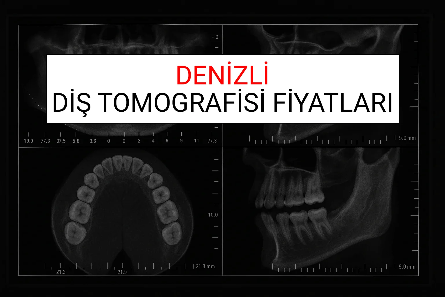 Denizli Diş Tomografisi Fiyatları Ne Kadar? (2025 TDB Denizli Diş Tomografisi Ücreti)