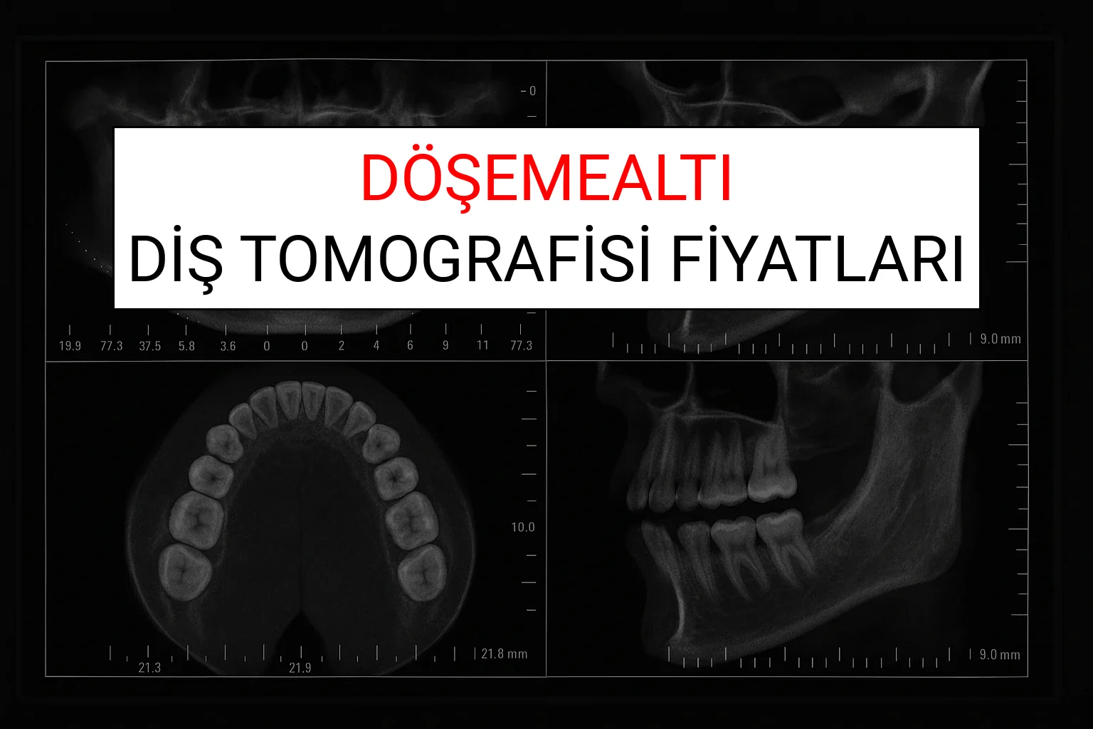 Döşemealtı Diş Tomografisi Fiyatları Ne Kadar? (2025 TDB Döşemealtı Diş Tomografisi Ücreti)