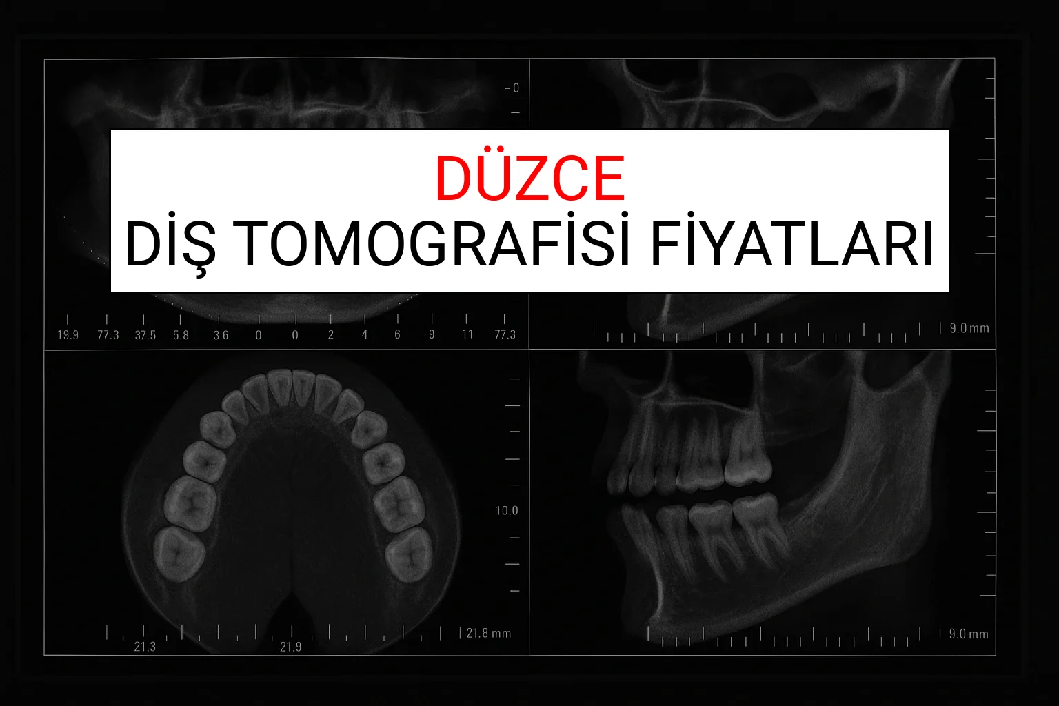 Düzce Diş Tomografisi Fiyatları Ne Kadar? (2025 TDB Düzce Diş Tomografisi Ücreti)