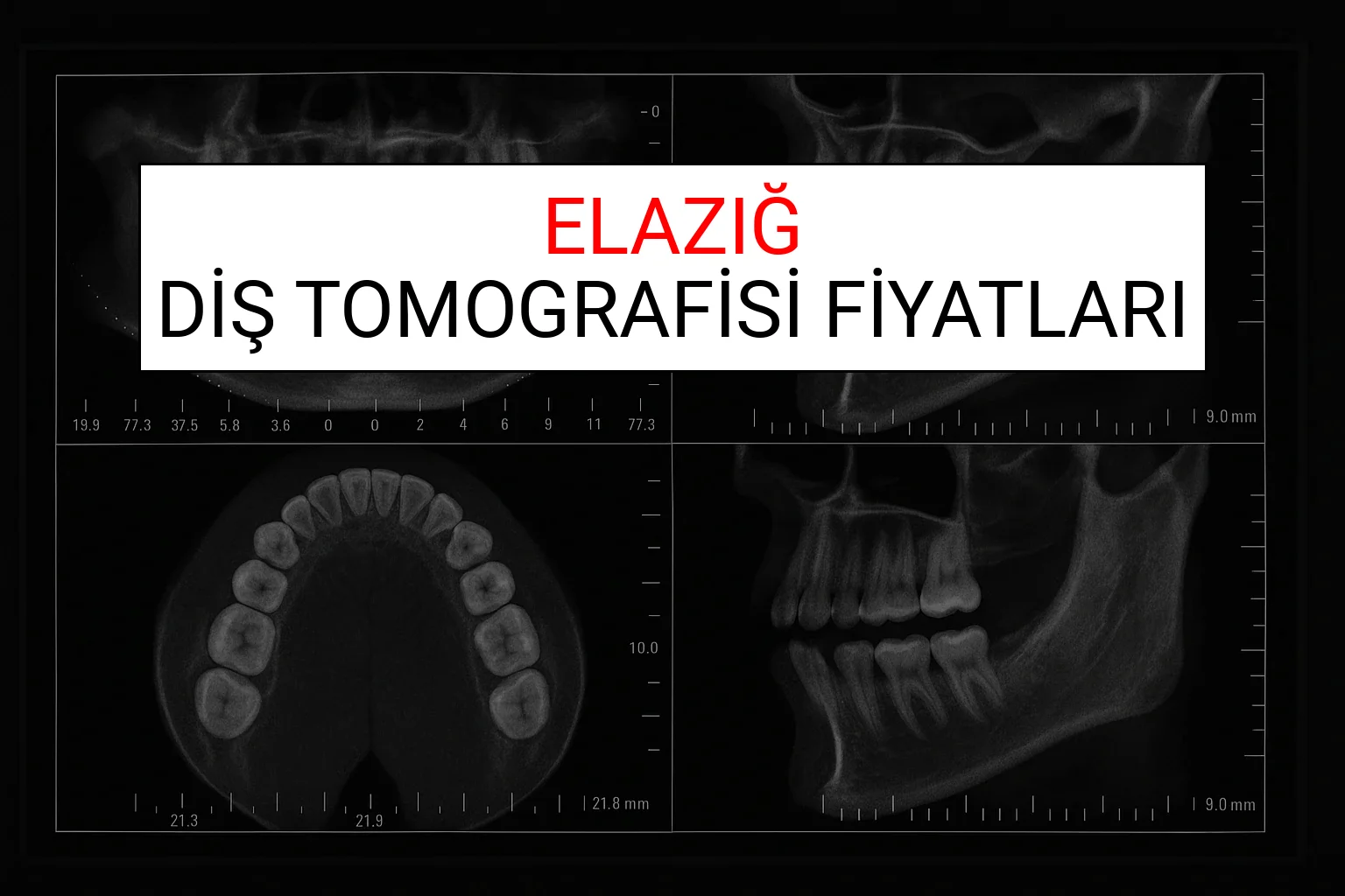 Elazığ Diş Tomografisi Fiyatları Ne Kadar? (2025 TDB Elazığ Diş Tomografisi Ücreti)