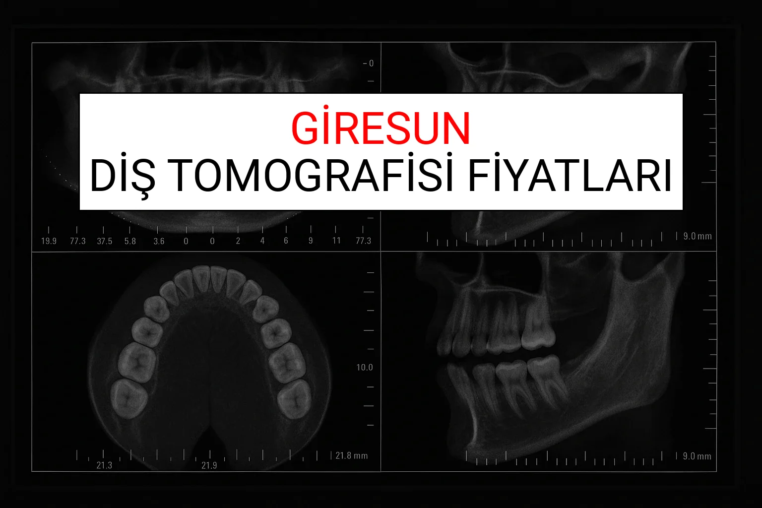 Giresun Diş Tomografisi Fiyatları Ne Kadar? (2025 TDB Giresun Diş Tomografisi Ücreti)
