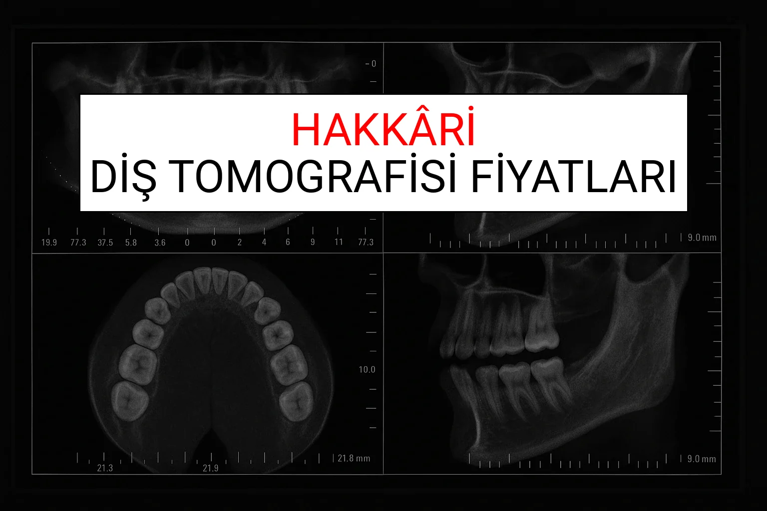 Hakkâri Diş Tomografisi Fiyatları Ne Kadar? (2025 TDB Hakkâri Diş Tomografisi Ücreti)