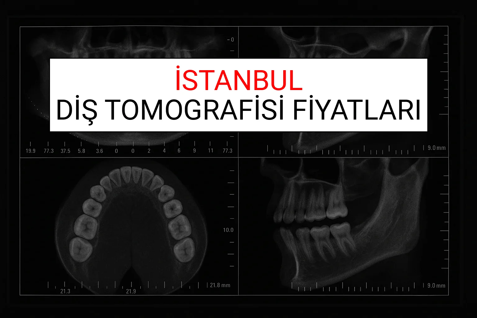 İstanbul Diş Tomografisi Fiyatları Ne Kadar? (2025 TDB İstanbul Diş Tomografisi Ücreti)