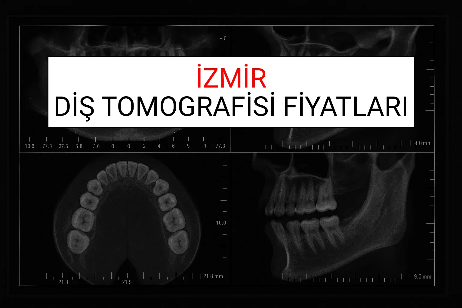 İzmir Diş Tomografisi Fiyatları Ne Kadar? (2025 TDB İzmir Diş Tomografisi Ücreti)