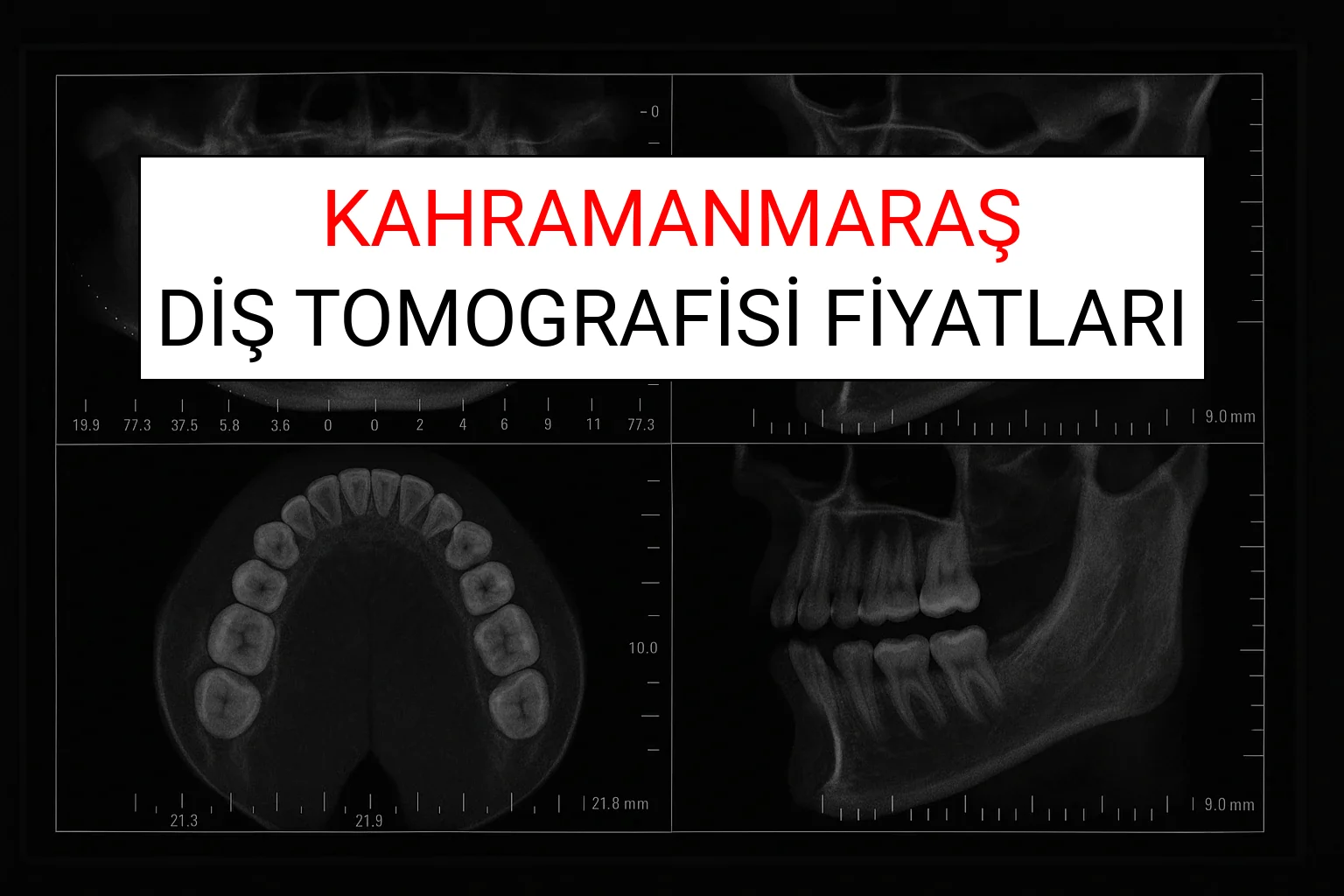 Kahramanmaraş Diş Tomografisi Fiyatları Ne Kadar? (2025 TDB Kahramanmaraş Diş Tomografisi Ücreti)