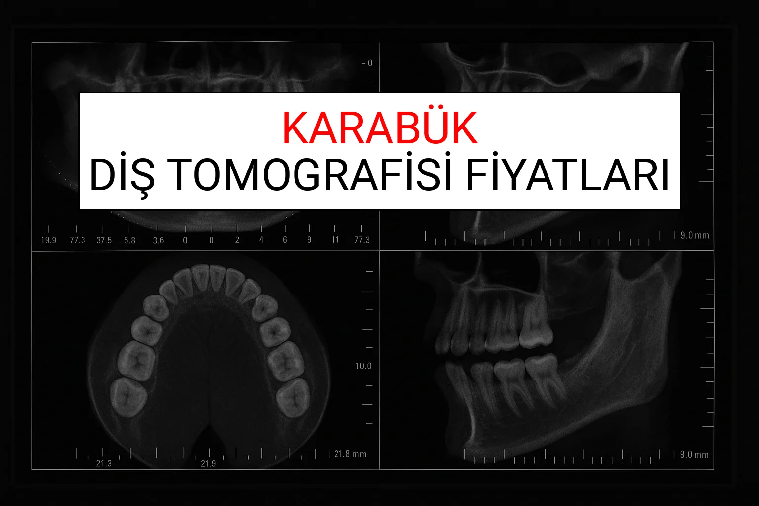 Karabük Diş Tomografisi Fiyatları Ne Kadar? (2025 TDB Karabük Diş Tomografisi Ücreti)