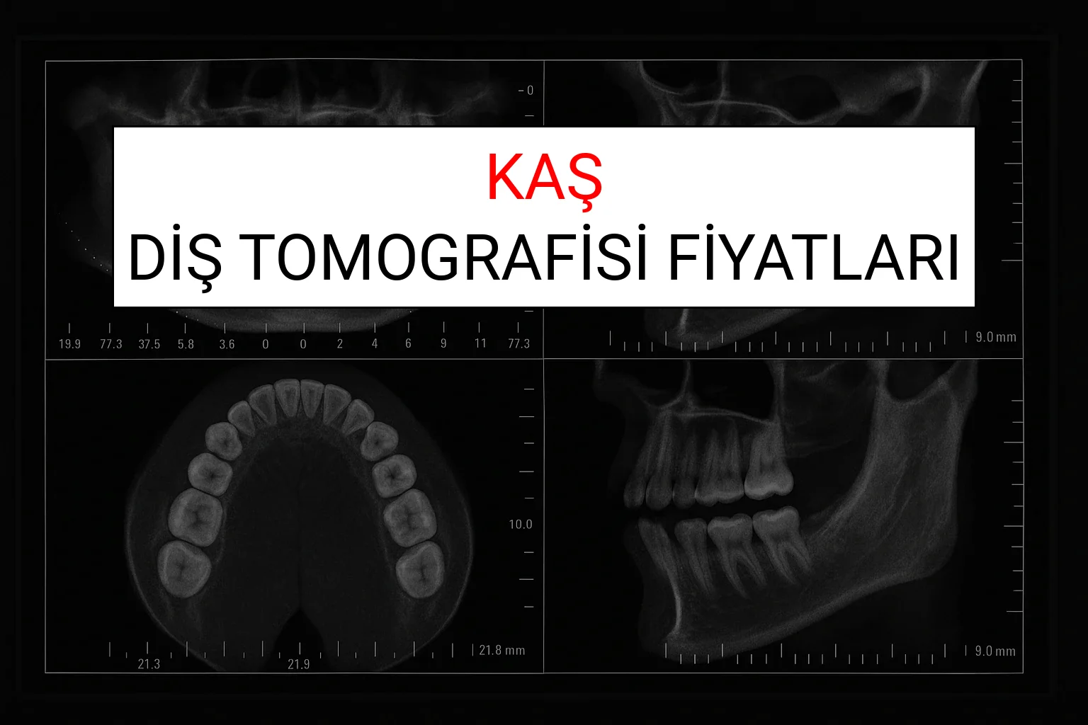 Kaş Diş Tomografisi Fiyatları Ne Kadar? (2025 TDB Kaş Diş Tomografisi Ücreti)