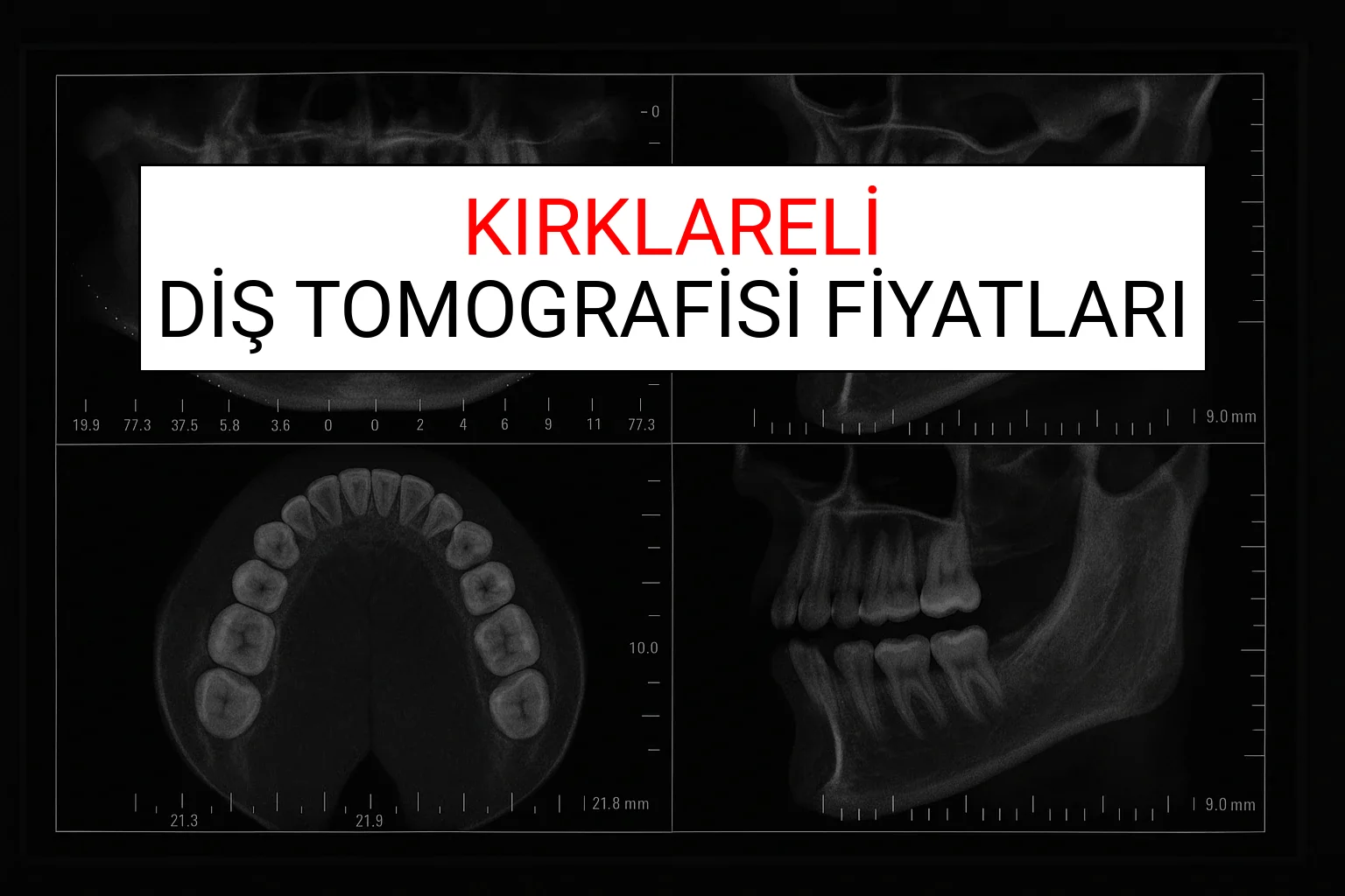 Kırklareli Diş Tomografisi Fiyatları Ne Kadar? (2025 TDB Kırklareli Diş Tomografisi Ücreti)