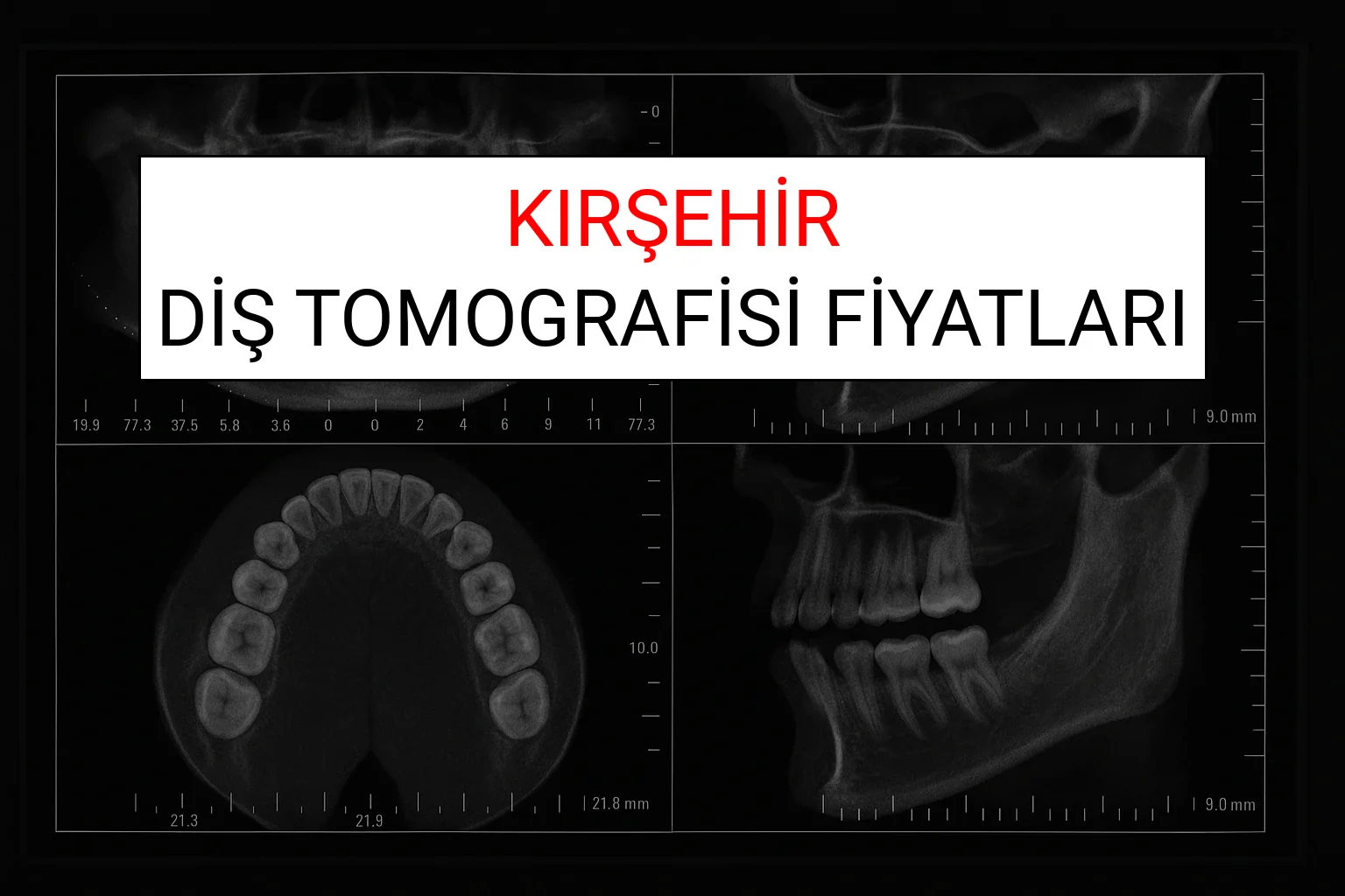 Kırşehir Diş Tomografisi Fiyatları Ne Kadar? (2025 TDB Kırşehir Diş Tomografisi Ücreti)