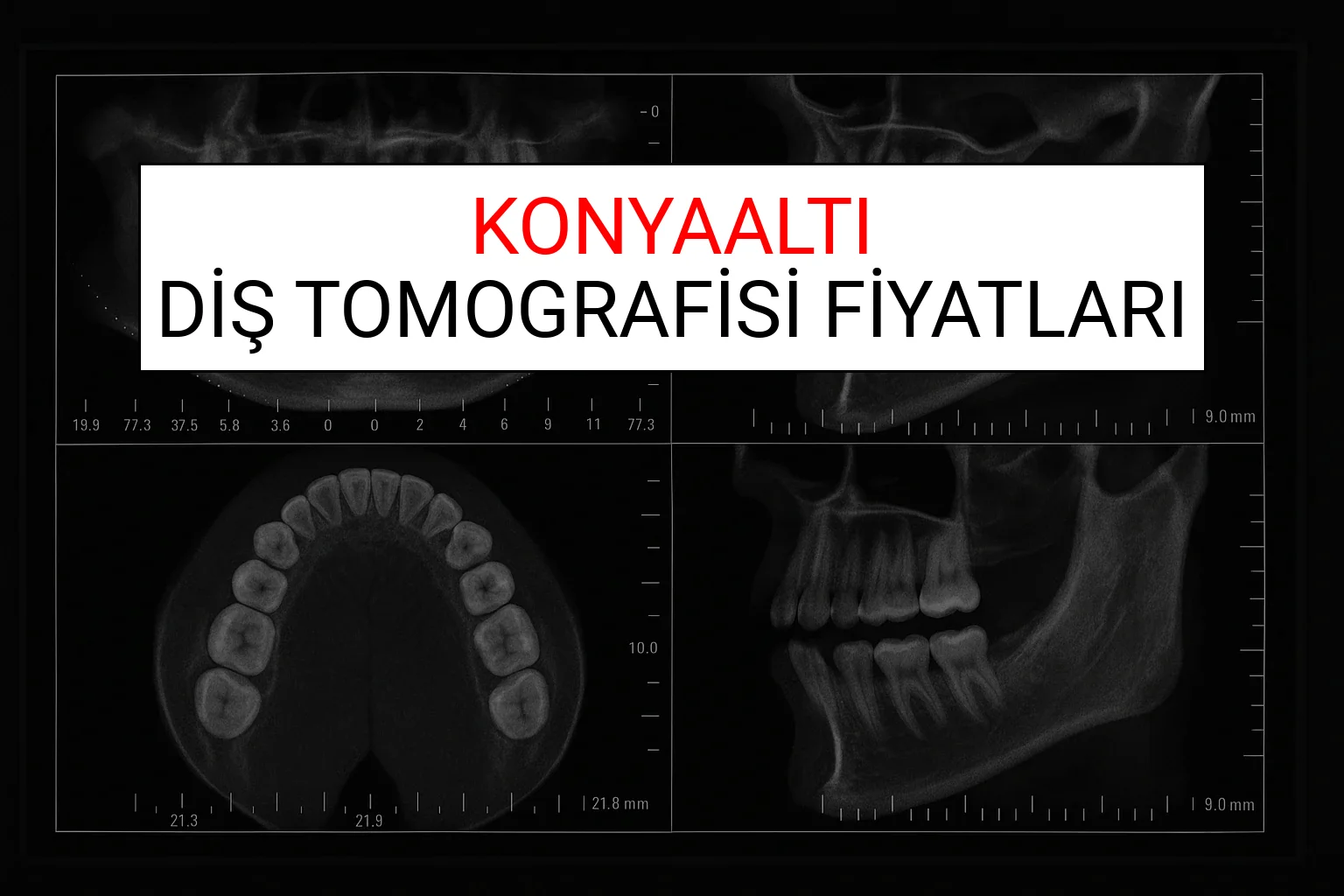 Konya Diş Tomografisi Fiyatları Ne Kadar? (2025 TDB Konya Diş Tomografisi Ücreti)
