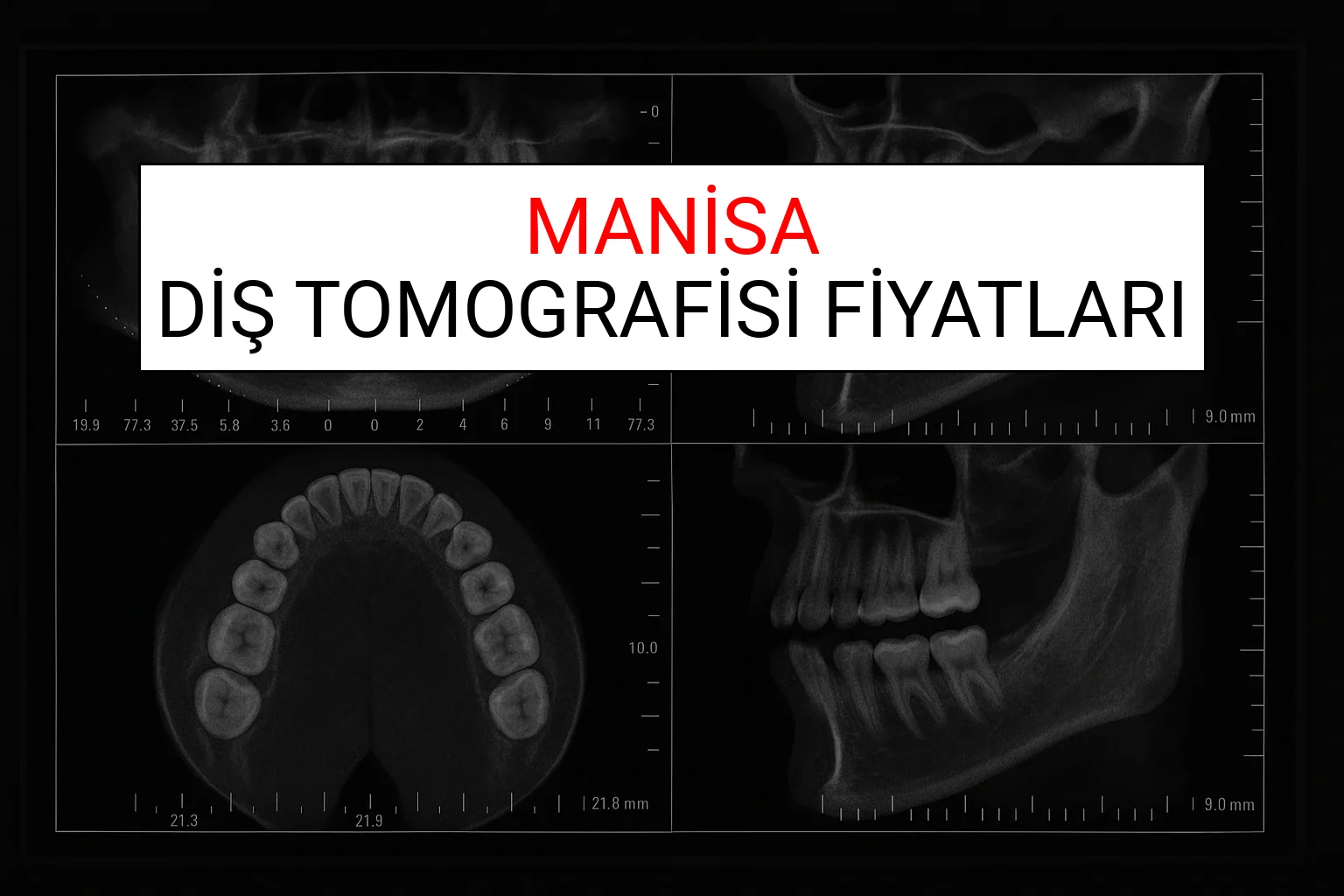 Manisa Diş Tomografisi Fiyatları Ne Kadar? (2025 TDB Manisa Diş Tomografisi Ücreti)