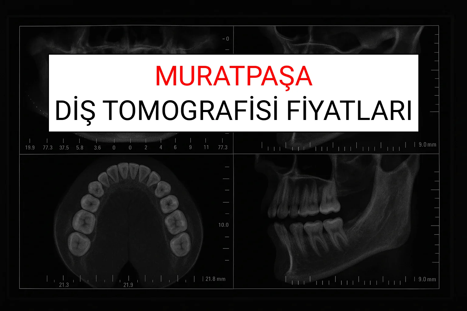 Muratpaşa Diş Tomografisi Fiyatları Ne Kadar? (2025 TDB Muratpaşa Diş Tomografisi Ücreti)