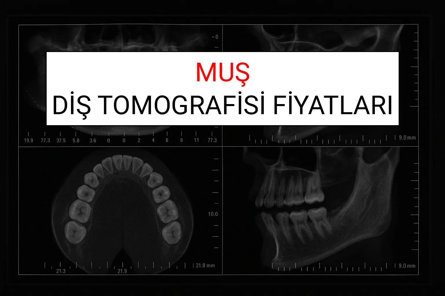 Muş Diş Tomografisi Fiyatları Ne Kadar? (2025 TDB Muş Diş Tomografisi Ücreti)