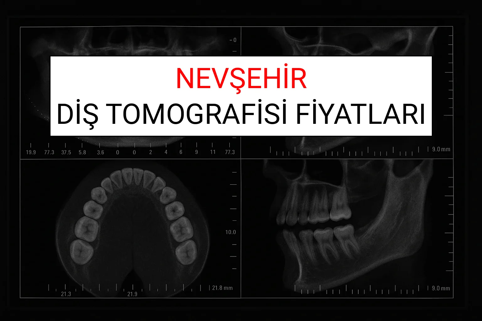 Nevşehir Diş Tomografisi Fiyatları Ne Kadar? (2025 TDB Nevşehir Diş Tomografisi Ücreti)