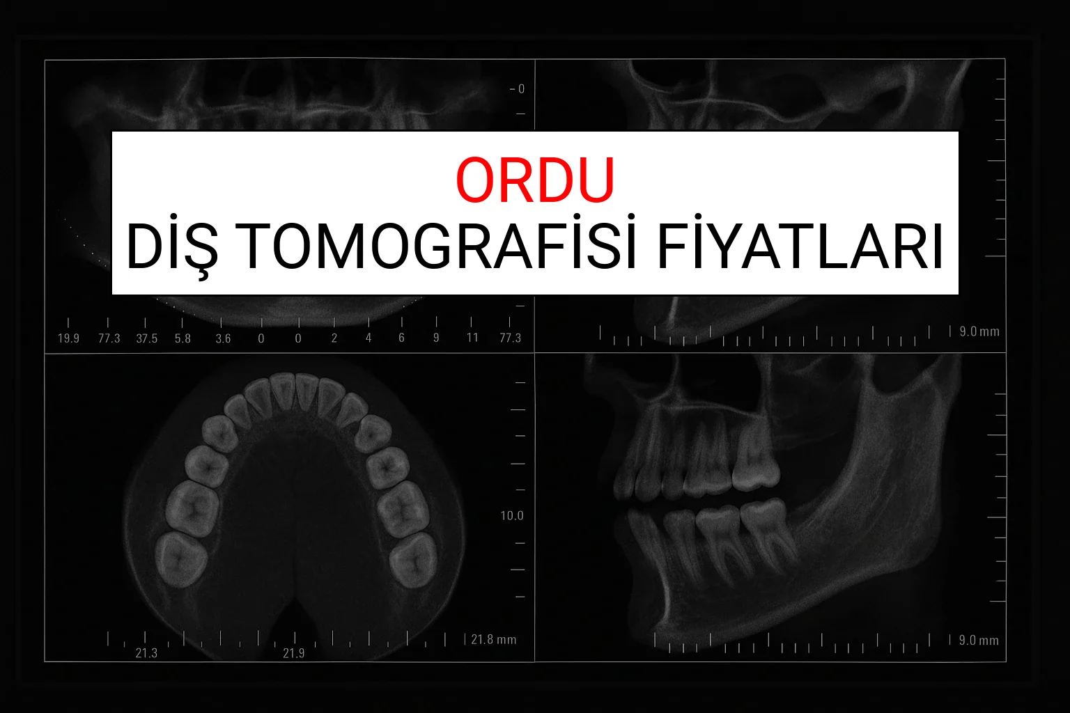 Ordu Diş Tomografisi Fiyatları Ne Kadar? (2025 TDB Ordu Diş Tomografisi Ücreti)