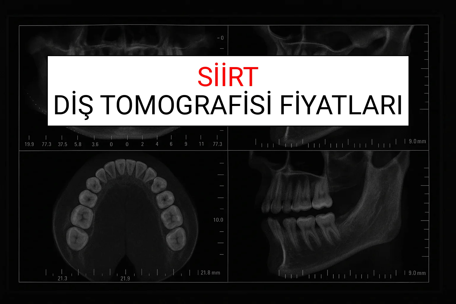 Siirt Diş Tomografisi Fiyatları Ne Kadar? (2025 TDB Siirt Diş Tomografisi Ücreti)