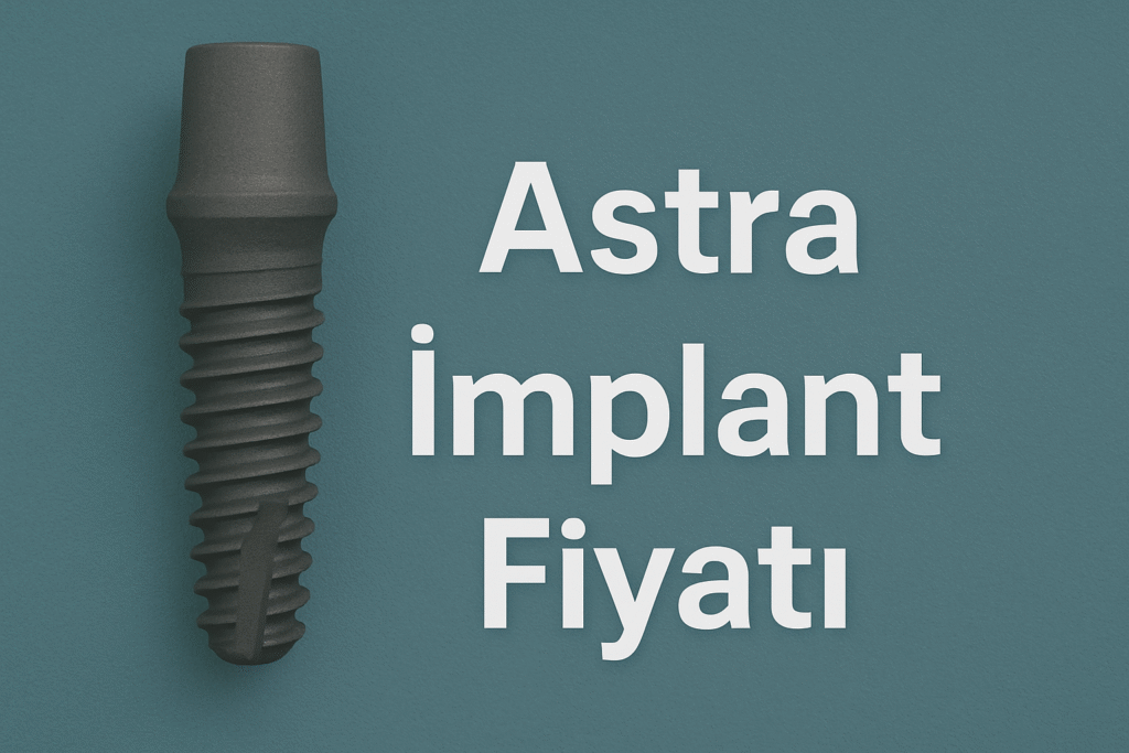 Astra İmplant Fiyatı