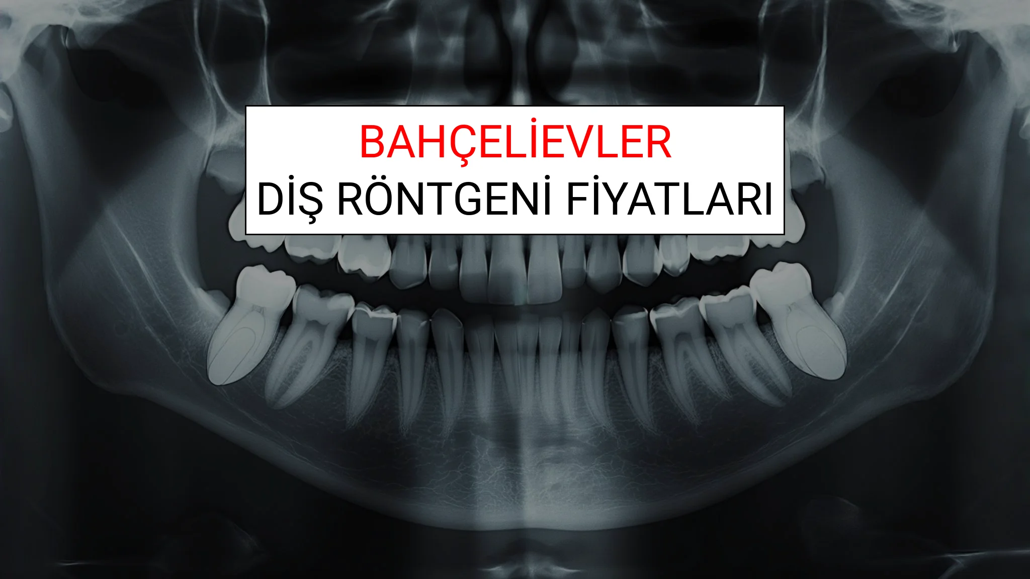 Bahçelievler Diş Röntgeni (Periapikal) Fiyatları Ne Kadar? (2025 TDB Bahçelievler Diş Röntgeni Ücreti)