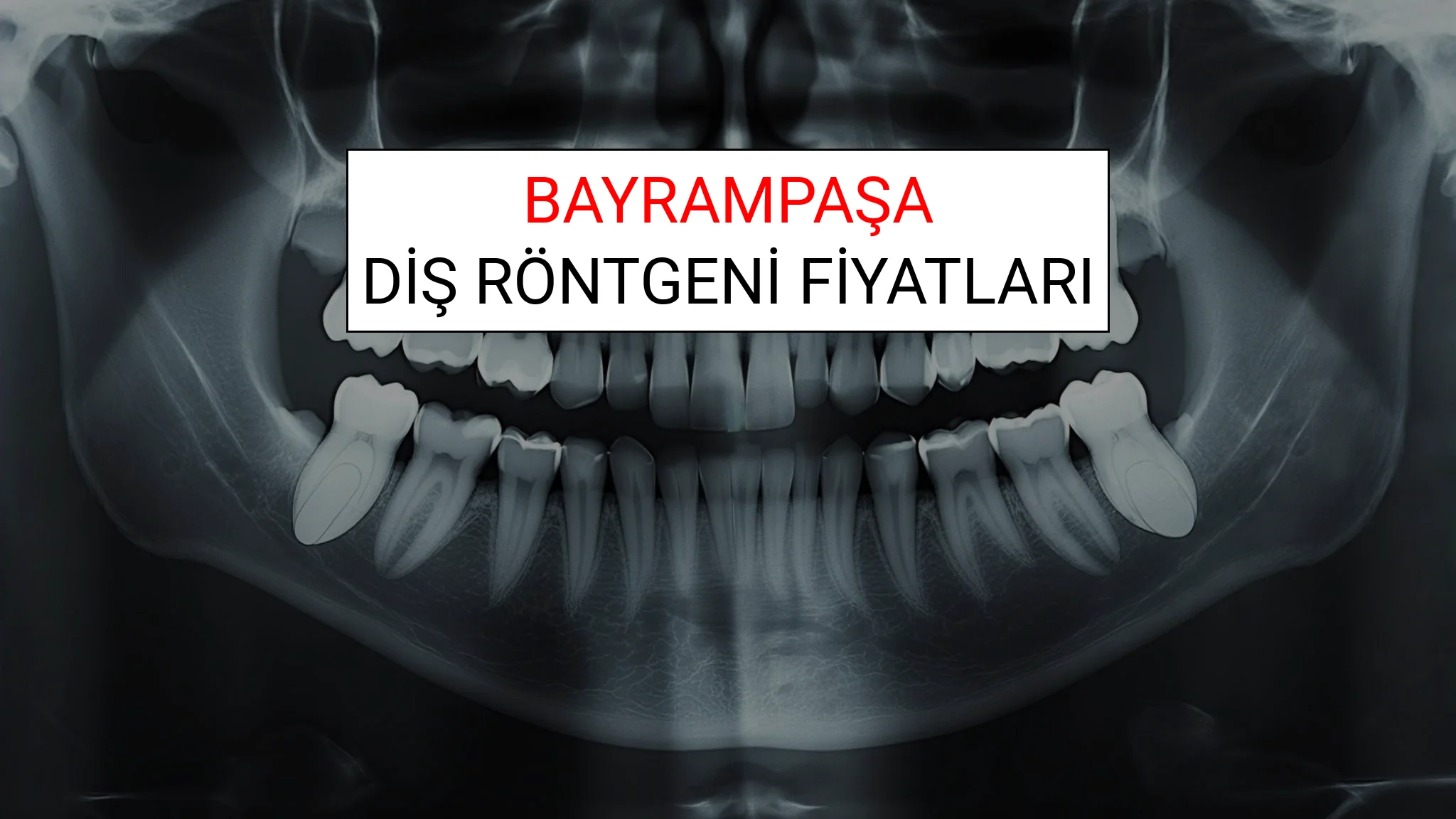 Bayrampaşa Diş Röntgeni (Periapikal) Fiyatları Ne Kadar? (2025 TDB Bayrampaşa Diş Röntgeni Ücreti)
