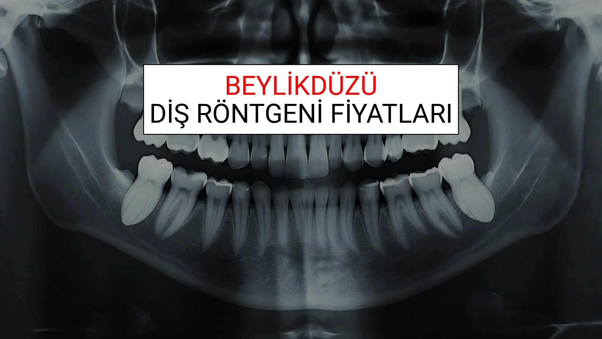 Beylikdüzü Diş Röntgeni (Periapikal) Fiyatları Ne Kadar? (2025 TDB Beylikdüzü Diş Röntgeni Ücreti)