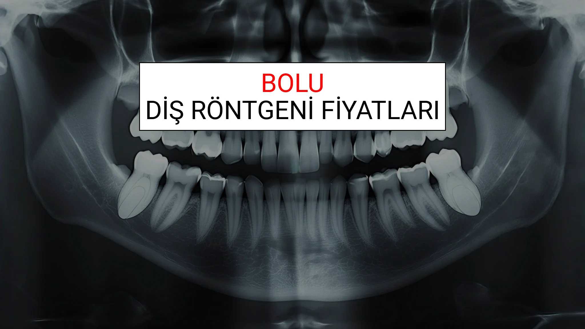 Bolu Diş Röntgeni (Periapikal) Fiyatları Ne Kadar? (2025 TDB Bolu Diş Röntgeni Ücreti)