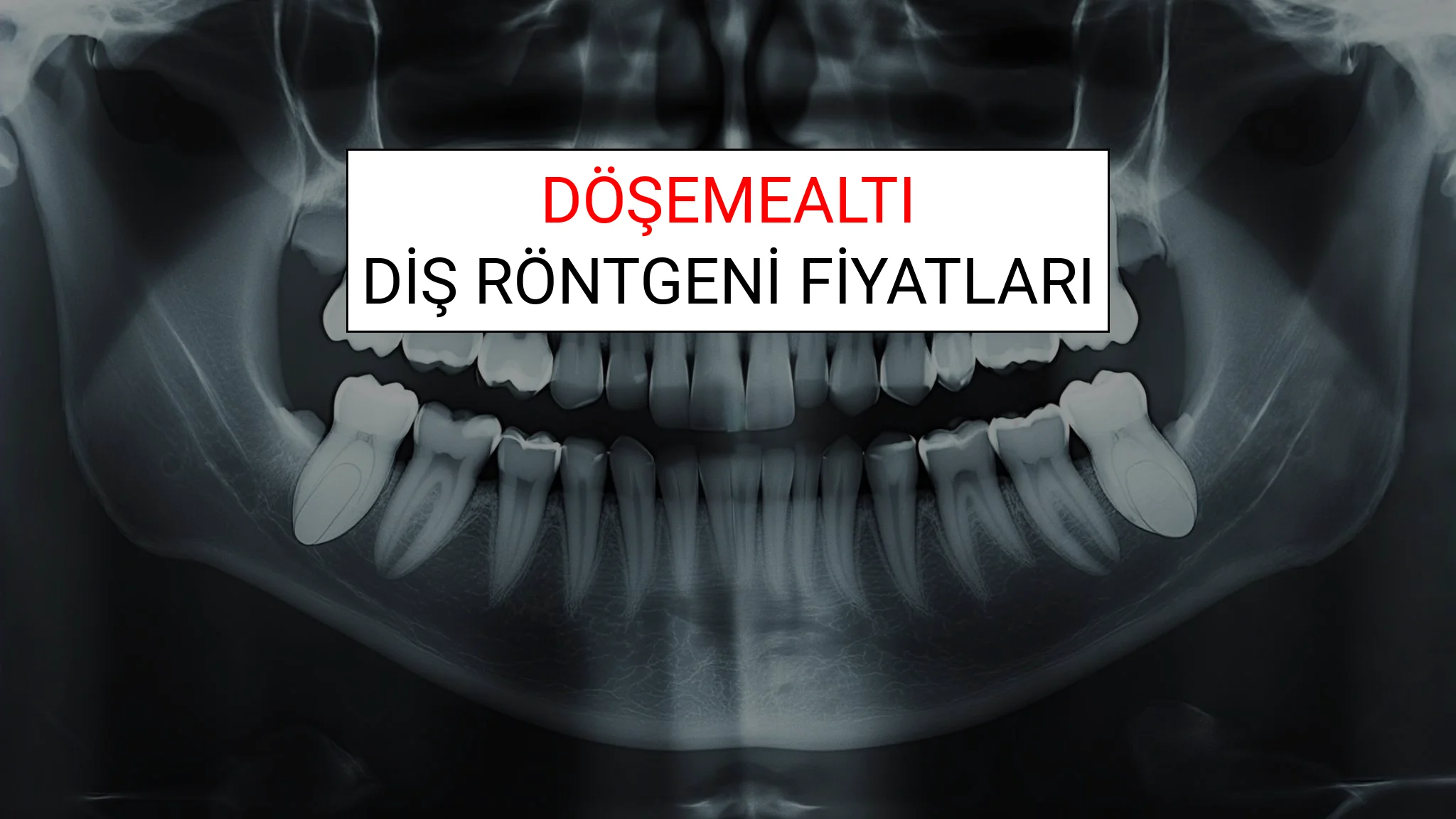 Döşemealtı Diş Röntgeni (Periapikal) Fiyatları Ne Kadar? (2025 TDB Döşemealtı Diş Röntgeni Ücreti)