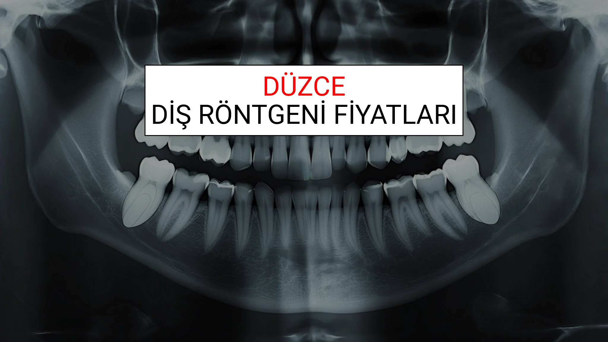 Düzce Diş Röntgeni (Periapikal) Fiyatları Ne Kadar? (2025 TDB Düzce Diş Röntgeni Ücreti)
