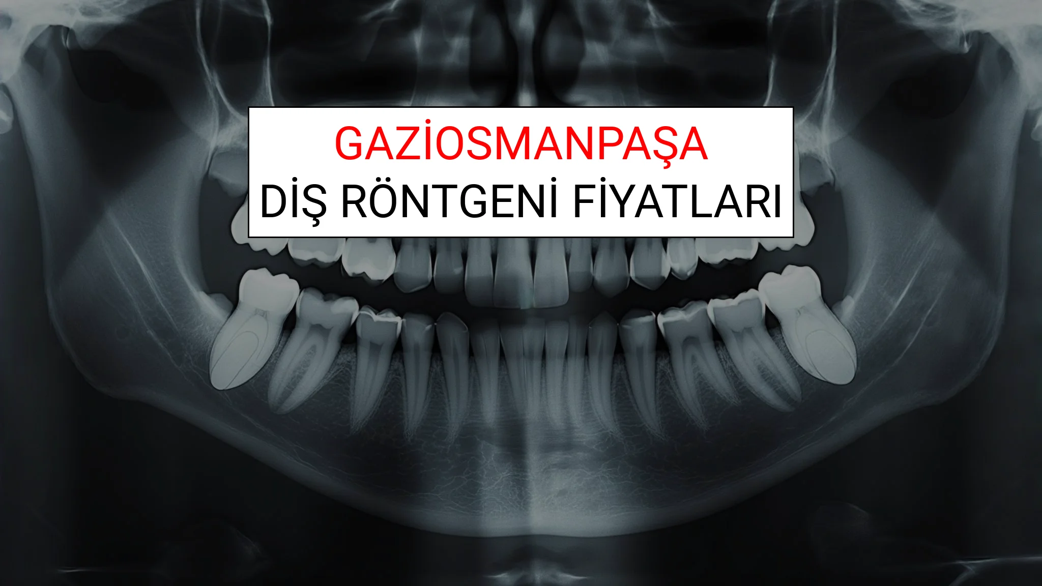 Gaziosmanpaşa Diş Röntgeni (Periapikal) Fiyatları Ne Kadar? (2025 TDB Gaziosmanpaşa Diş Röntgeni Ücreti)
