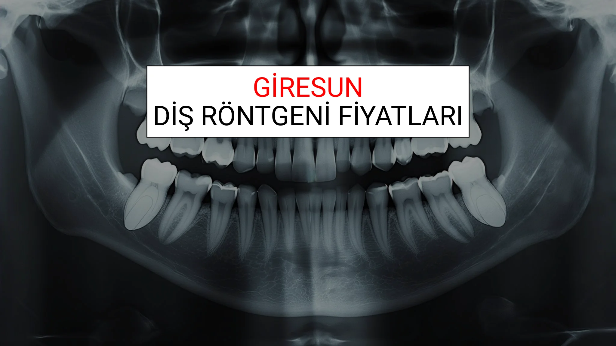 Giresun Diş Röntgeni (Periapikal) Fiyatları Ne Kadar? (2025 TDB Giresun Diş Röntgeni Ücreti)