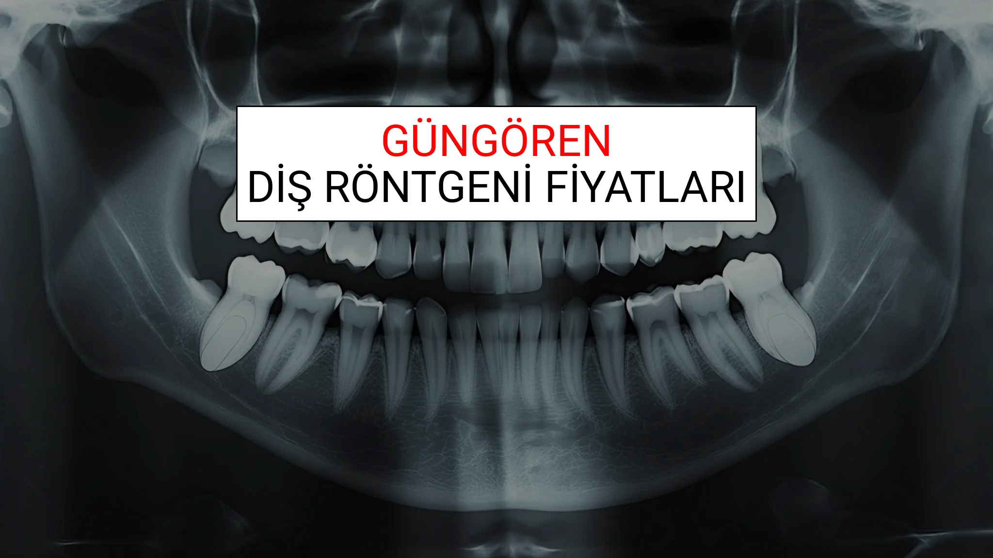 Güngören Diş Röntgeni (Periapikal) Fiyatları Ne Kadar? (2025 TDB Güngören Diş Röntgeni Ücreti)