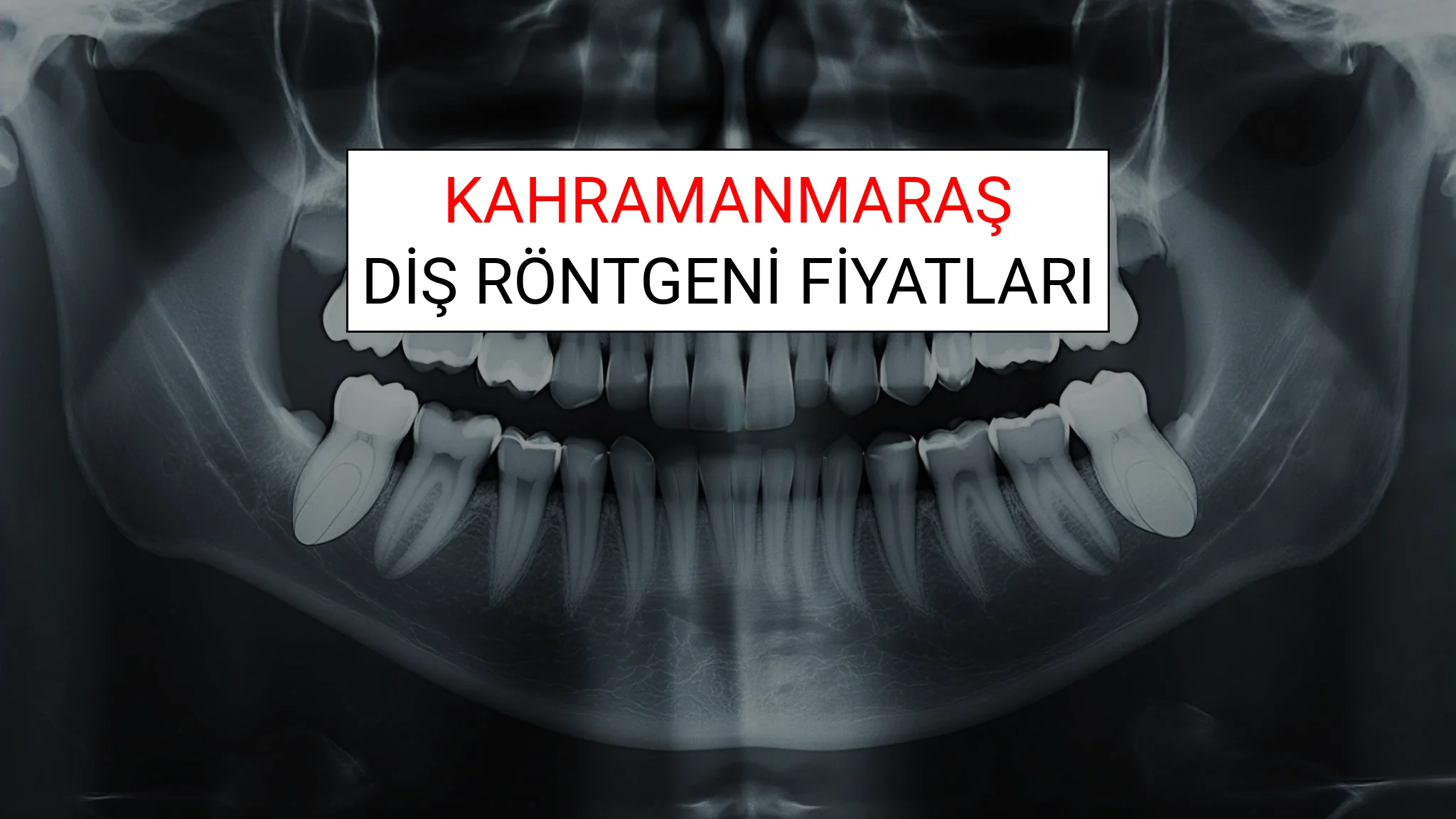 Kahramanmaraş Diş Röntgeni (Periapikal) Fiyatları Ne Kadar? (2025 TDB Kahramanmaraş Diş Röntgeni Ücreti)