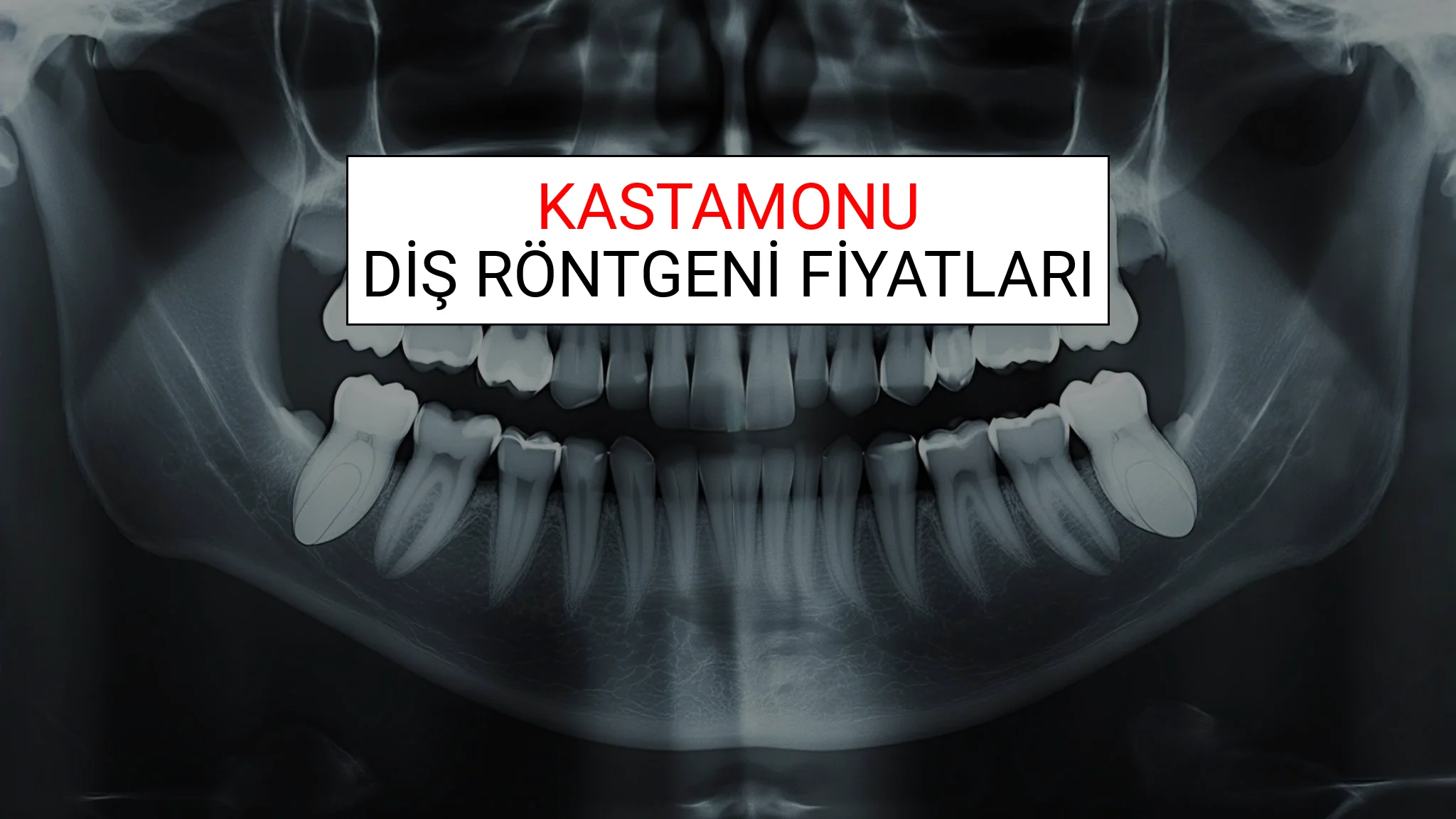 Kastamonu Diş Röntgeni (Periapikal) Fiyatları Ne Kadar? (2025 TDB Kastamonu Diş Röntgeni Ücreti)