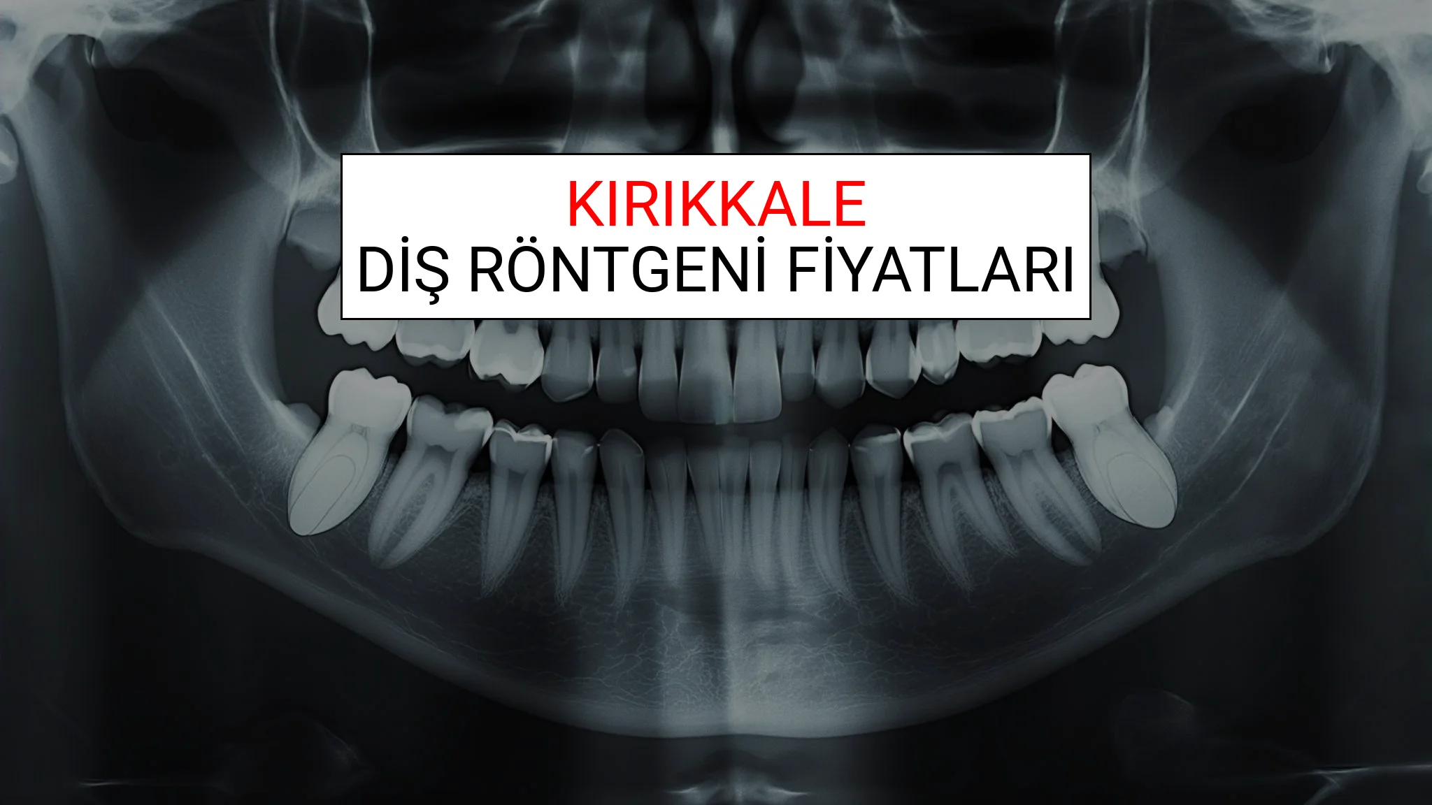 Kırıkkale Diş Röntgeni (Periapikal) Fiyatları Ne Kadar? (2025 TDB Kırıkkale Diş Röntgeni Ücreti)