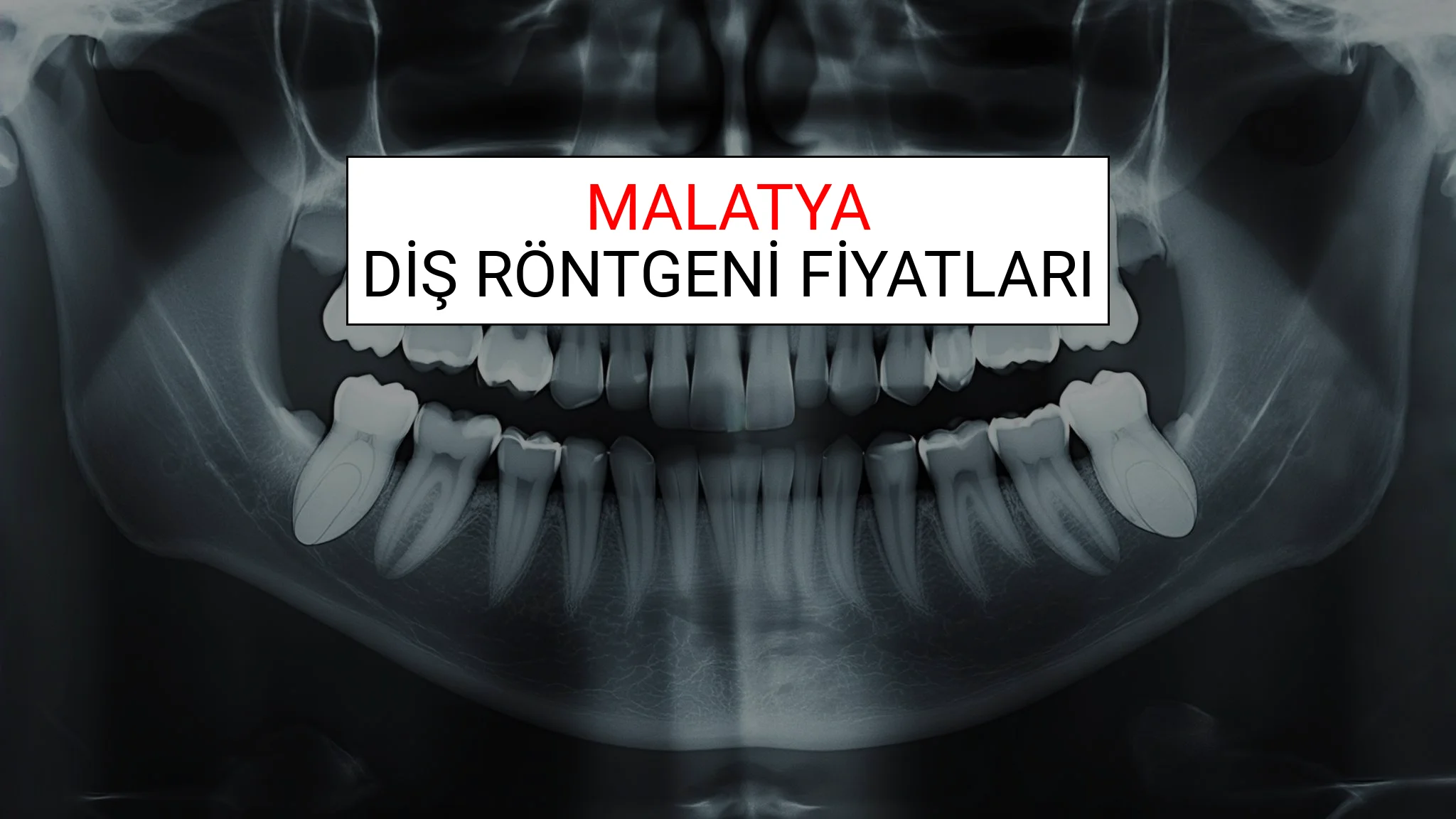 Malatya Diş Röntgeni (Periapikal) Fiyatları Ne Kadar? (2025 TDB Malatya Diş Röntgeni Ücreti)