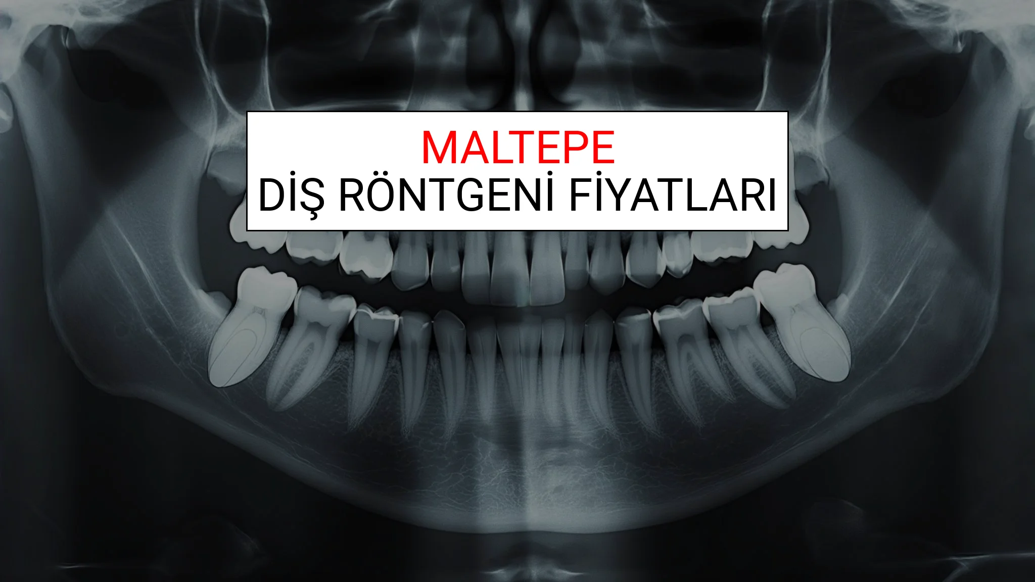 Maltepe Diş Röntgeni (Periapikal) Fiyatları Ne Kadar? (2025 TDB Maltepe Diş Röntgeni Ücreti)