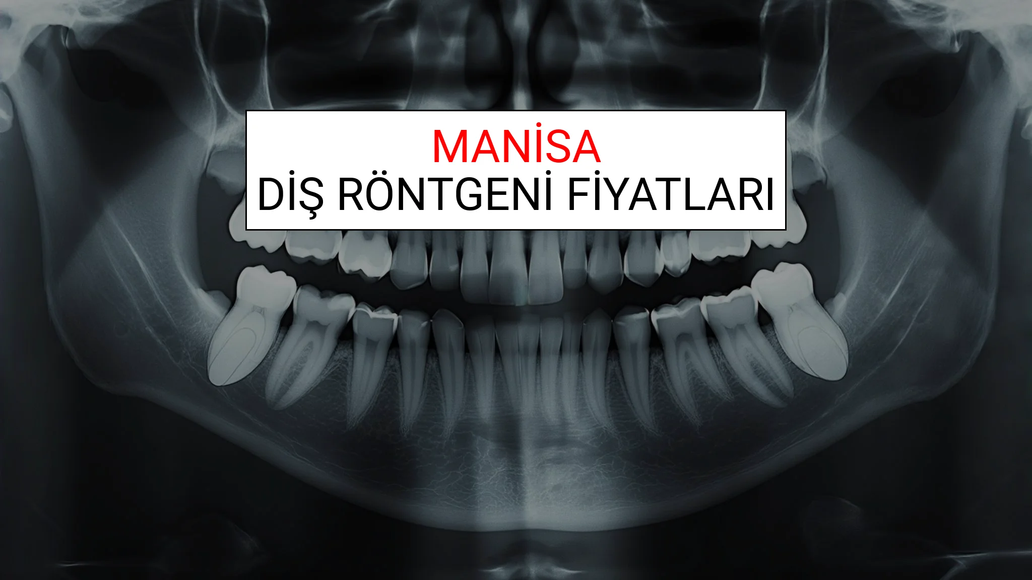 Manisa Diş Röntgeni (Periapikal) Fiyatları Ne Kadar? (2025 TDB Manisa Diş Röntgeni Ücreti)