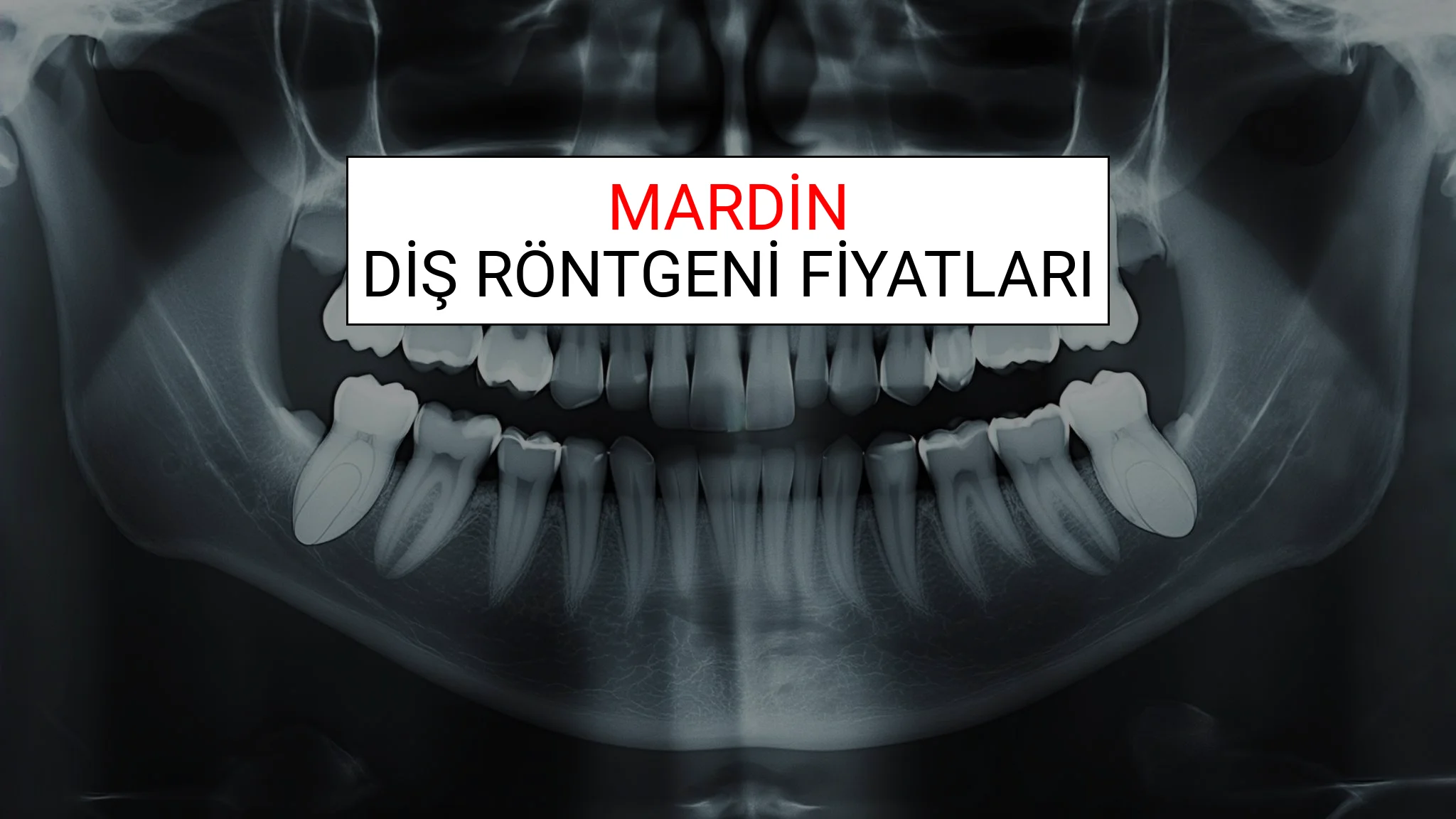 Mardin Diş Röntgeni (Periapikal) Fiyatları Ne Kadar? (2025 TDB Mardin Diş Röntgeni Ücreti)